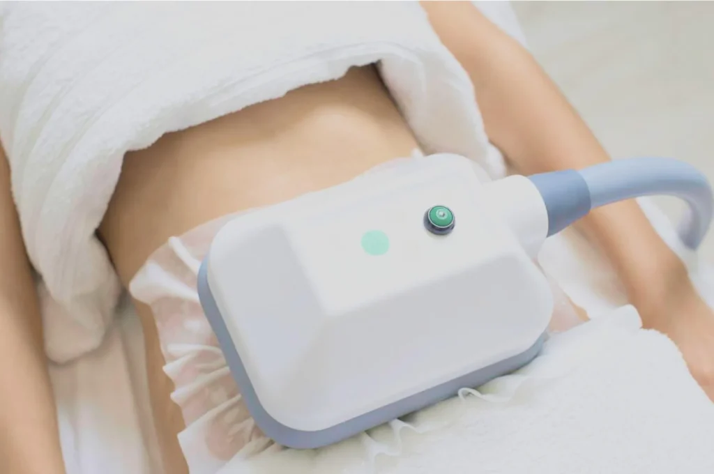 How Fat Freezing and HIFU Work Together? 3 advantages to combining Fat Freezing and HIFU Paisley