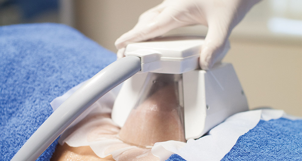 How Fat Freezing and HIFU Work Together? 2 Multiple Areas in One Session HIFU and Fat Freezing Paisley