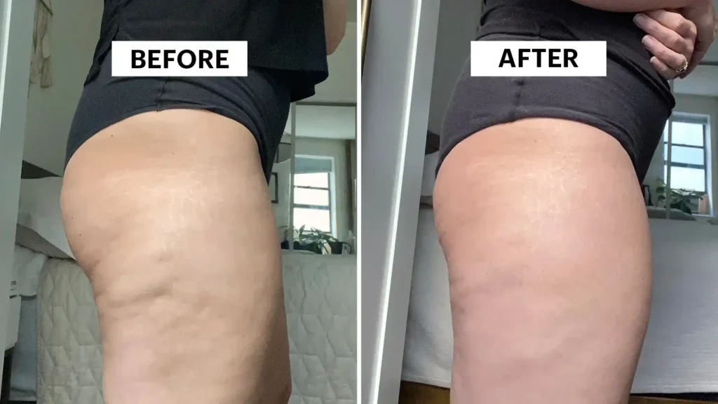 Do Toning Exercise Paisley Really Tackle Cellulite?