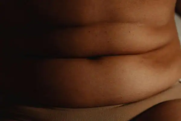 The Hidden Connection: How Stress Shapes Your Fitness and Body Composition 3 image of what stress can do on the stomach area and how Lipo 360 Paisley can help to change your body shape.